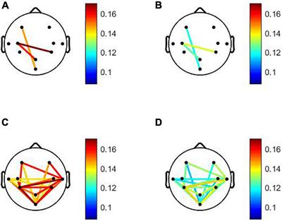 Functional Brain Networks in Mild Cognitive Impairment Based on Resting Electroencephalography Signals